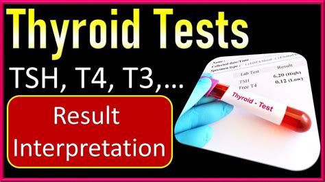 what else can impact thyroid tests|thyroid test results explained.